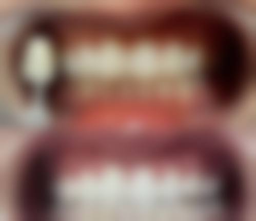 深圳恒碩口腔真实实例