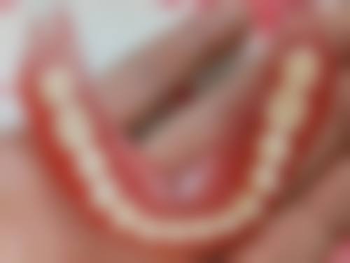 北京贝齿佳口腔门诊部治疗洗牙后一年多牙酸靠谱吗？