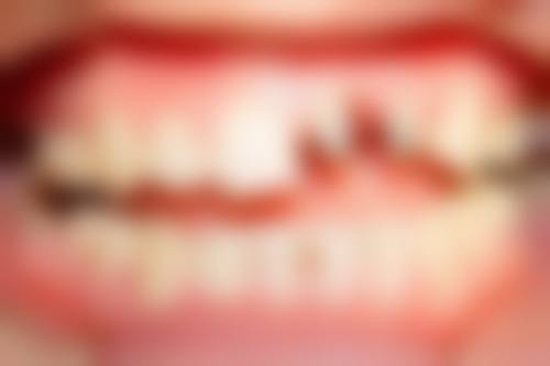 信阳众大口腔诊所预约挂号方式：多种途径任你选