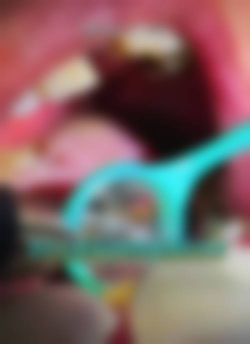 乌鲁木齐郎朗上口口腔诊所真实实例大分享