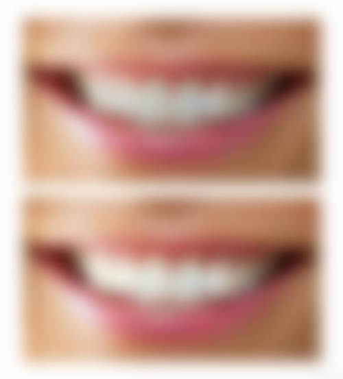 浙江温州美博口腔预约挂号方式：便捷多样随心选