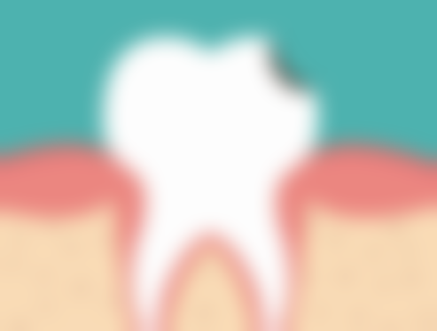 劲松口腔医院德国BEGO种植体靠谱吗？