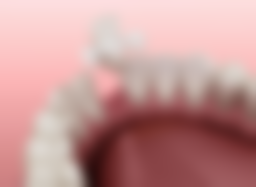 儿童蛀牙根管治疗后需要注意什么？