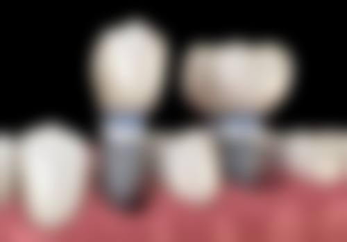 东莞天使口腔（长安镇分院）价格表