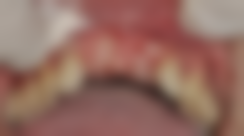 山东潍坊经济刘洁口腔诊所价格表