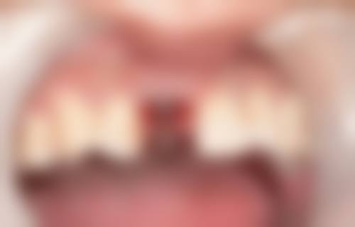 北京京大博爱口腔的预约挂号方式