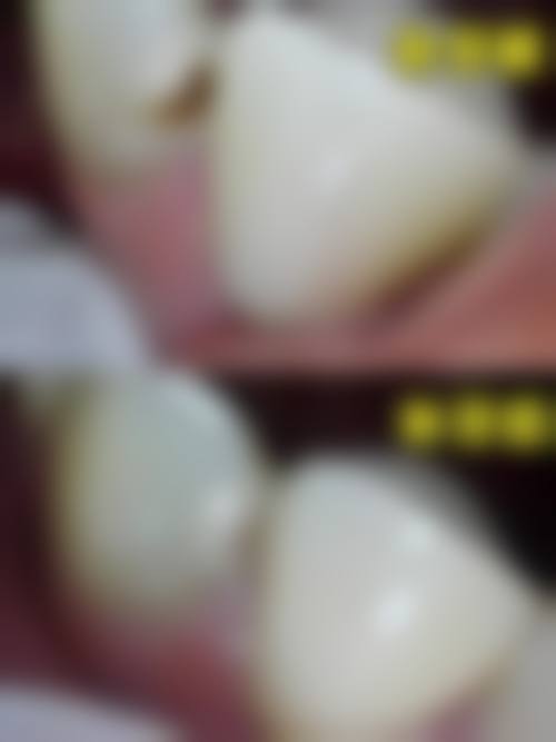 陕西西安蓝田温润玲口腔诊所地址及乘车路线