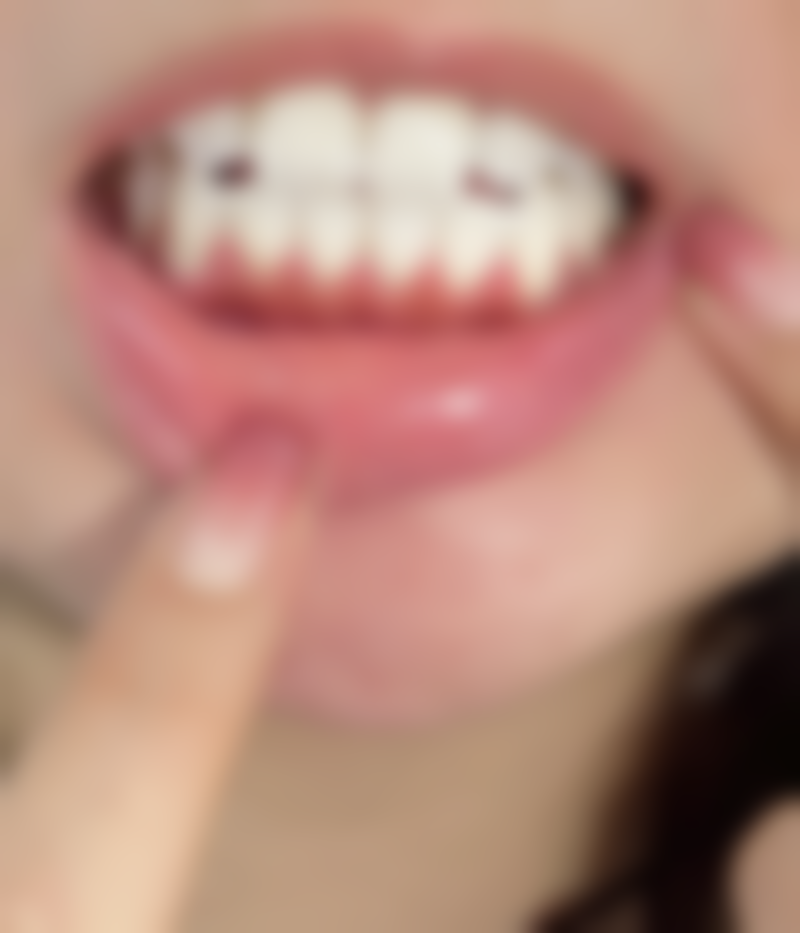 眼科黄荣海院长擅长项目