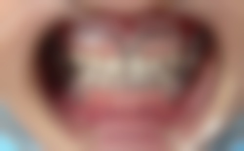 尹万洋医生技术特点