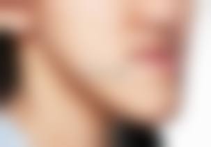 苏州昆山云舒口腔门诊部真实实例：见证美牙奇迹的发生