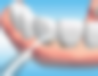 杭州杭皓口腔（杭玻街店）口碑怎么样