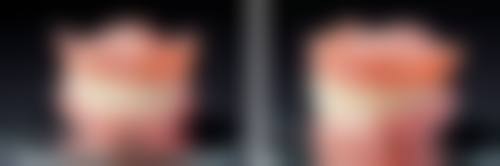 沈阳杏林整形医院洗牙变白值不值？