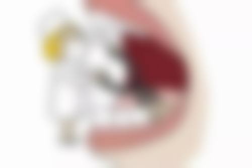 何氏眼科医院洗牙变白适合哪些人？