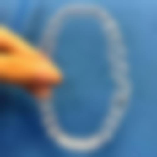 河南南阳方城万超口腔诊所陈旭医生做牙齿矫正靠谱吗