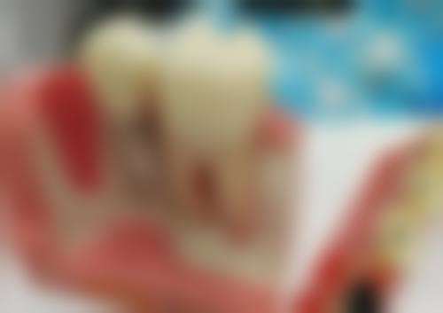 广西钦州周全口腔真实实例:见证神奇改变