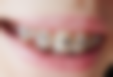 黄荣海医生的技术特点