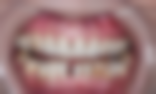 安徽芜湖中江口腔真实实例