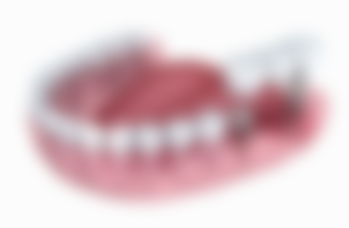 北京明珠口腔门诊部擅长项目