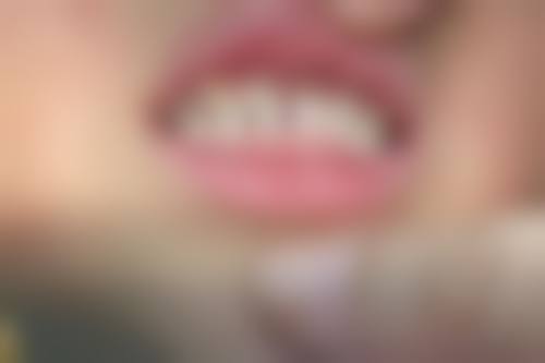 商丘睢阳新城美迪口腔门诊部（香君店）价格表