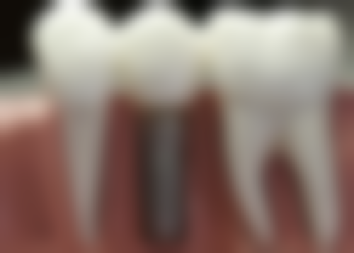 太康县人民医院口腔科口碑怎么样