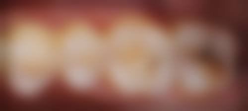 甘肃金昌储天佑口腔诊所预约挂号方式：多种途径任你选