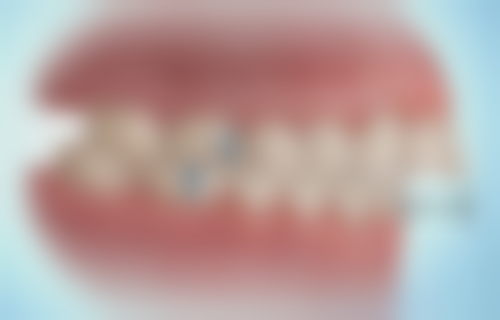 北京京大博爱口腔门诊部的丁义医生经验多吗