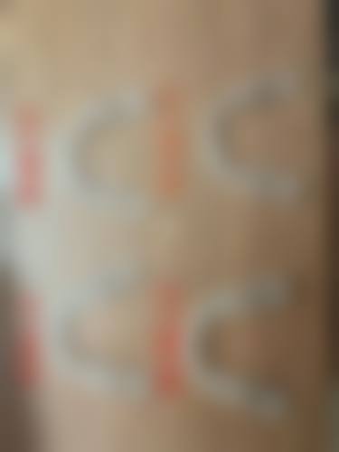 种植牙植体品牌有哪些？口腔专家揭秘TOP5优质品牌，让你告别缺牙烦恼一步到位！ 