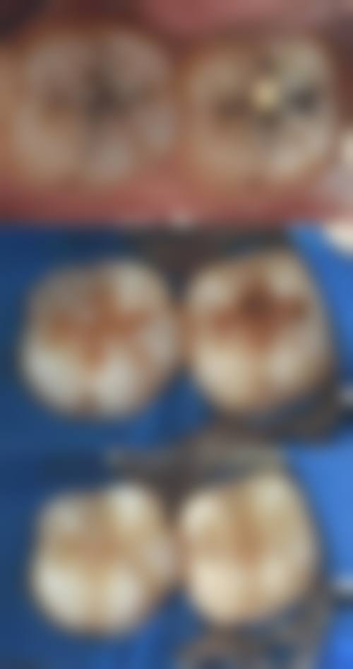 呼和浩特聚仁口腔门诊部价格表