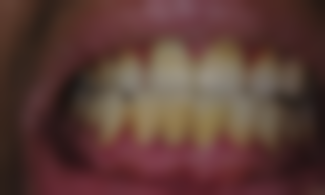 黄筱华医生真实实例：见证奇迹，重拾自信