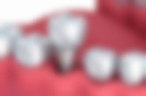 泰州市泰兴叶军明口腔仪器设备