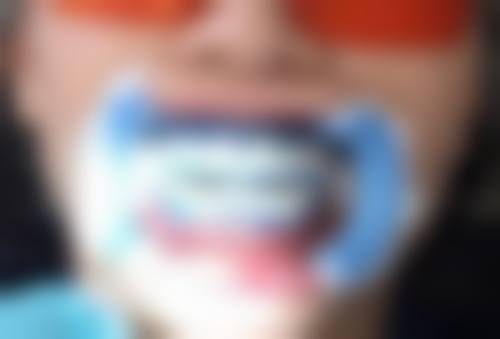 北京京大博爱口腔门诊部许俊豪手术成效能维持多久