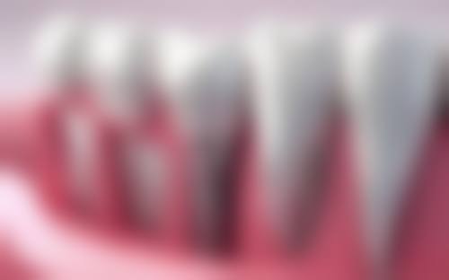 北京法兰克福联合口腔医院价格表:透明合理,性价比极高