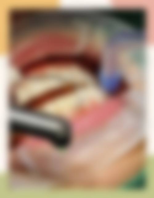 驻马店嘉益口腔门诊部价格表