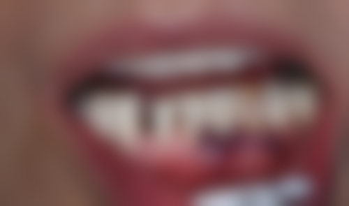 中山洁齿口腔预约挂号方式：便捷效率高不等待