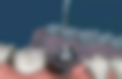 大连市口腔医院口腔外科价格表