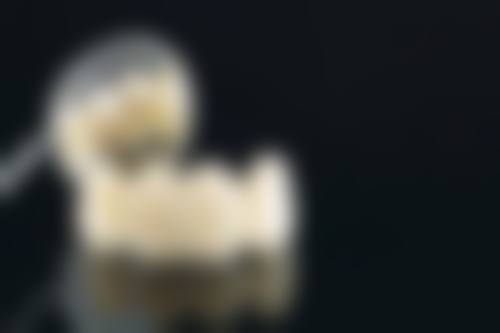 银川诺贝尔口腔门诊部补牙后装牙冠走医疗保险怎么样？