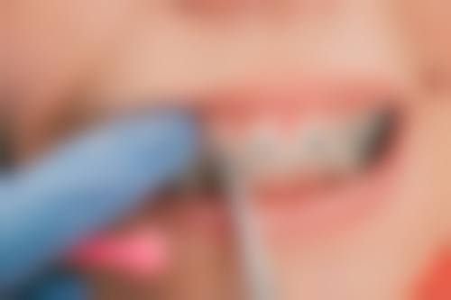 山东泰安大志口腔真实实例：成效看得见