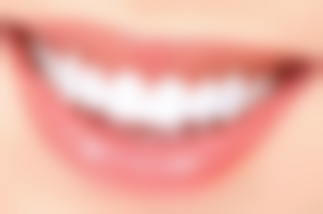 不用洗牙去除牙结石值不值