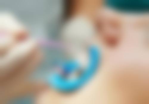 哪些情况矫正时拔牙比较合适？