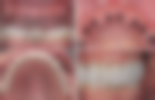 河南商丘市中 心医院口腔科擅长项目