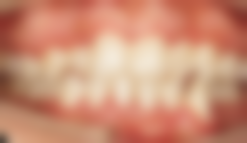 宫风勇医生技术特点