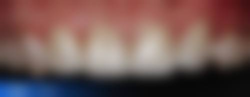 西安蕙美口腔诊所电话号码：随时沟通不等待