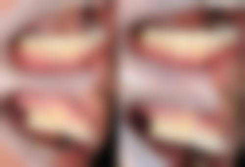 长沙刘良术口腔诊所仪器设备：精良科技助力治疗