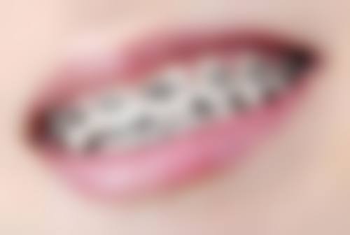 拔牙有什么讲究吗?下午不能拔吗？揭秘拔牙时间、禁忌等讲究，让你拔牙不再迷茫！ 