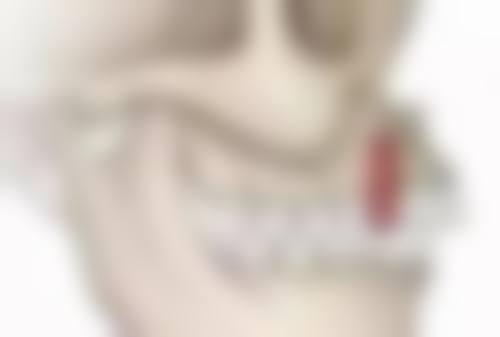 补牙m3材料在贝色24小时牙科医院值不值