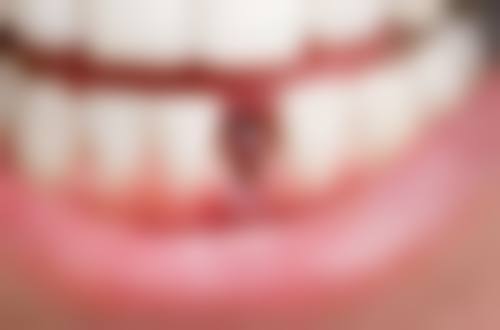 北京佳美经典口腔医院医生名单