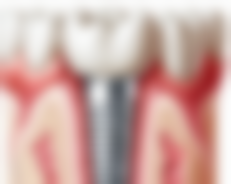 贵州铜仁爱齿口腔诊所口碑怎么样