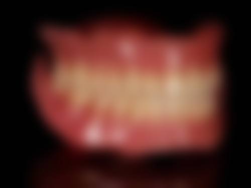 有牙结石去郴州植贝尔口腔医院怎么样？