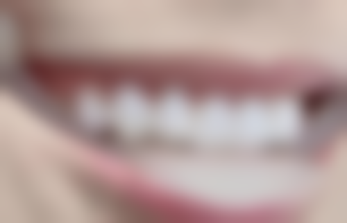 通州区许俊豪手术价格受哪些因素影响?