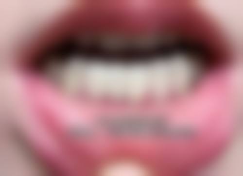 张掖华康口腔医院擅长项目